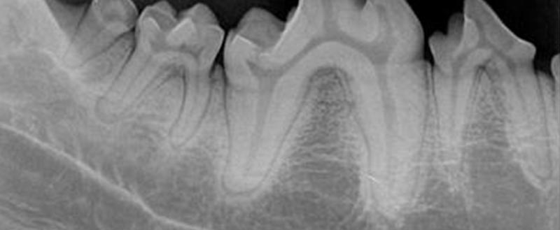 牙科X光